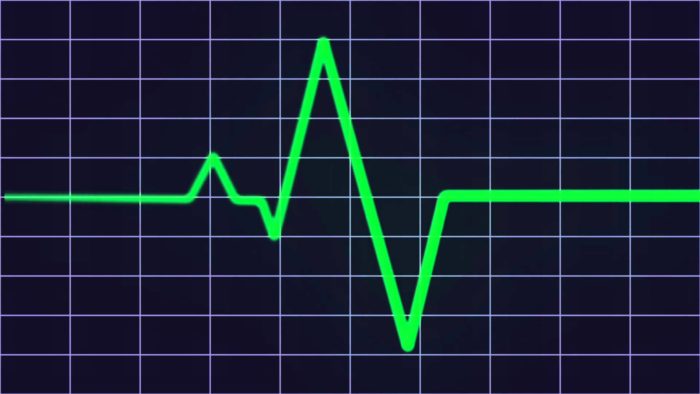 Target Heartrate for Fat Loss: Truth or Myth? 3